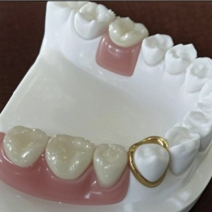 Attachement de précision